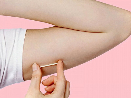 Introduction of the contraceptive (Implanon) | UltraSave