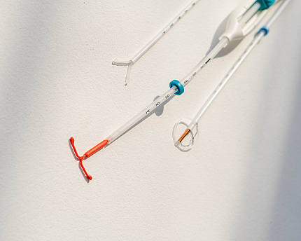 Removal of an intrauterine device (IUD) | UltraSave